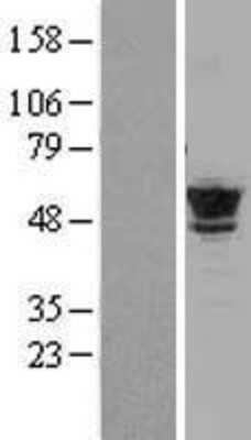 Western Blot: Tubulin Beta 2C Overexpression Lysate [NBL1-17439]