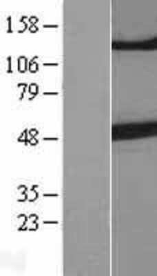 Western Blot: beta-III Tubulin Overexpression Lysate [NBL1-17440]