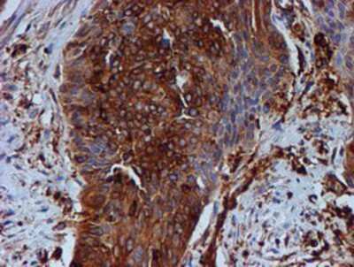 Immunohistochemistry-Paraffin: Tubulin Beta 4 Antibody (OTI3F1) [NBP2-00812]