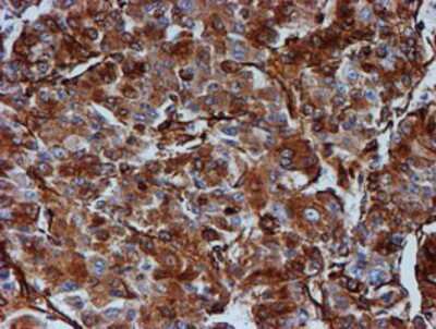 Immunohistochemistry-Paraffin: Tubulin Beta 4 Antibody (OTI3F1) [NBP2-00812]