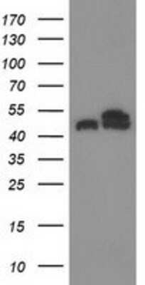 Western Blot: Tubulin Beta 4 Antibody (OTI3F1) [NBP2-00812]