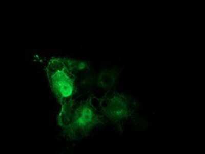 Immunocytochemistry/ Immunofluorescence: Tubulin Beta 4 Antibody (OTI3F1) - Azide and BSA Free [NBP2-74713]