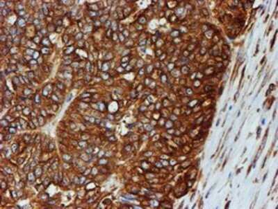 Immunohistochemistry: Tubulin Beta 4 Antibody (OTI3F1) - Azide and BSA Free [NBP2-74713]