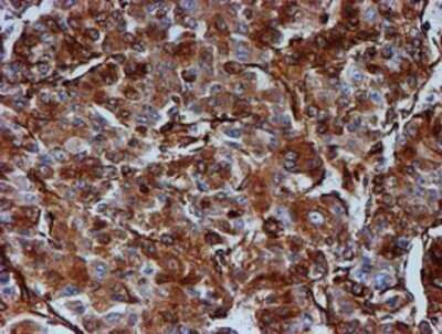 Immunohistochemistry: Tubulin Beta 4 Antibody (OTI3F1) - Azide and BSA Free [NBP2-74713]