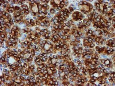 Immunohistochemistry: Tubulin Beta 4 Antibody (OTI3F1) - Azide and BSA Free [NBP2-74713]