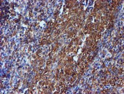 Immunohistochemistry: Tubulin Beta 4 Antibody (OTI3F1) - Azide and BSA Free [NBP2-74713]
