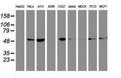Western Blot: Tubulin Beta 4 Antibody (OTI3F1)Azide and BSA Free [NBP2-74713]