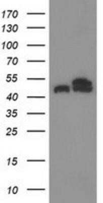 Western Blot: Tubulin Beta 4 Antibody (OTI3F1)Azide and BSA Free [NBP2-74713]