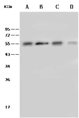 Western Blot: Tubulin Beta 4 Antibody [NBP2-99382]