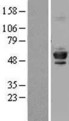 Western Blot: Tubulin Beta 4 Overexpression Lysate [NBL1-17441]