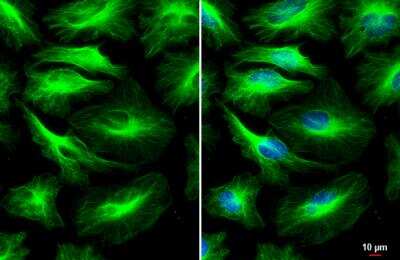 Immunocytochemistry/ Immunofluorescence: Tubulin alpha-1B Antibody (114) [NBP2-43837]