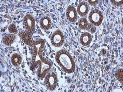 Immunohistochemistry-Paraffin: Tubulin alpha-1B Antibody (114) [NBP2-43837]