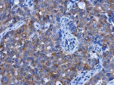Immunohistochemistry-Paraffin: Tubulin alpha-1B Antibody (114) [NBP2-43837]