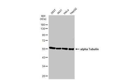 Tumorsphere: Tubulin alpha-1B Antibody (114) [NBP2-43837]