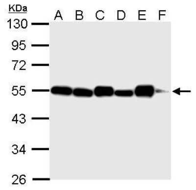Western Blot: Tubulin alpha-1B Antibody (114) [NBP2-43837]