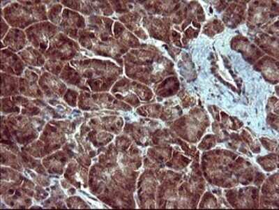 Immunohistochemistry: Tubulin alpha-1B Antibody (OTI3G3) [NBP2-46243]