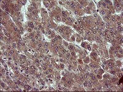 Immunohistochemistry: Tubulin alpha-1B Antibody (OTI3G3) [NBP2-46243]