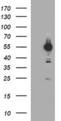 Western Blot: Tubulin alpha-1B Antibody (OTI3G3) [NBP2-46243]