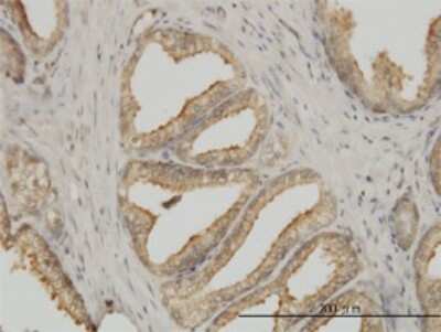 Immunohistochemistry-Paraffin: Tubulin alpha-1B Antibody (4D1) [H00010376-M01]