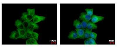 Immunocytochemistry/ Immunofluorescence: Tubulin alpha-1B Antibody [NBP2-20760]
