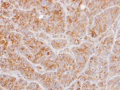 Immunohistochemistry-Paraffin: Tubulin alpha-1B Antibody [NBP1-32959]