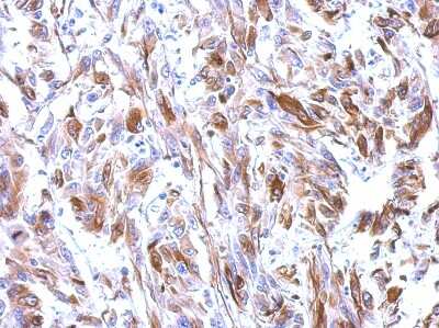 Immunohistochemistry-Paraffin: Tubulin alpha-1B Antibody [NBP2-20759]