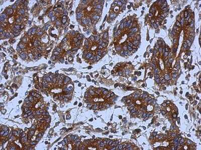 Immunohistochemistry-Paraffin: Tubulin alpha-1B Antibody [NBP2-20760]