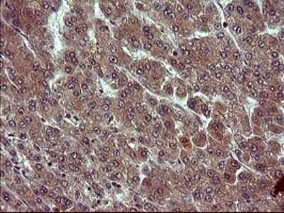Immunohistochemistry: Tubulin alpha-1B Antibody (OTI3G3) - Azide and BSA Free [NBP2-74703]