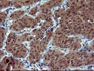 Immunohistochemistry: Tubulin alpha-1B Antibody (OTI3G3) - Azide and BSA Free [NBP2-74703]
