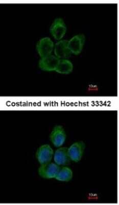 Immunocytochemistry/ Immunofluorescence: Tubulin alpha-8 Antibody [NBP1-32916]