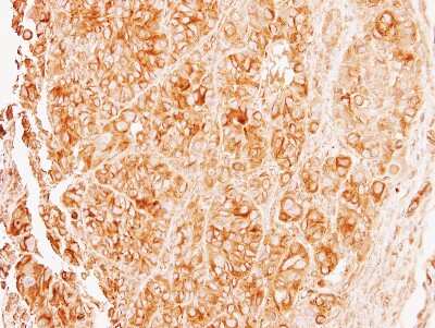 Immunohistochemistry-Paraffin: Tubulin alpha-8 Antibody [NBP1-32916]