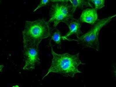 Immunocytochemistry/ Immunofluorescence: Tubulin alpha-8 Antibody (OTI2G6) - Azide and BSA Free [NBP2-74709]