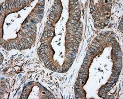 Immunohistochemistry-Paraffin: Tubulin alpha-8 Antibody (OTI2G6) [NBP2-02474]