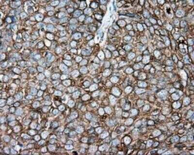 Immunohistochemistry-Paraffin: Tubulin alpha-8 Antibody (OTI2G6) [NBP2-02474]