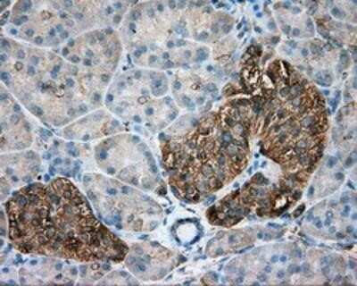Immunohistochemistry-Paraffin: Tubulin alpha-8 Antibody (OTI2G6) [NBP2-02474]