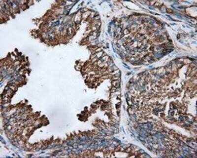 Immunohistochemistry-Paraffin: Tubulin alpha-8 Antibody (OTI2G6) [NBP2-02474]