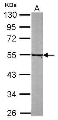 Western Blot: Tubulin alpha-8 Antibody [NBP1-32916]