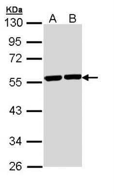 Western Blot: Tubulin alpha-8 Antibody [NBP1-32916]