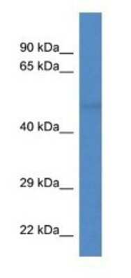 Western Blot: Tubulin alpha-8 Antibody [NBP1-74176]