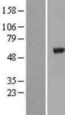 Western Blot: Tubulin alpha-8 Overexpression Lysate [NBL1-17434]