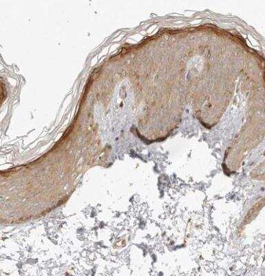 Immunohistochemistry-Paraffin: Tuftelin 1 Antibody [NBP1-87446]