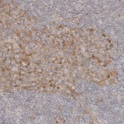 Immunohistochemistry-Paraffin: Tuftelin 1 Antibody [NBP1-87446]