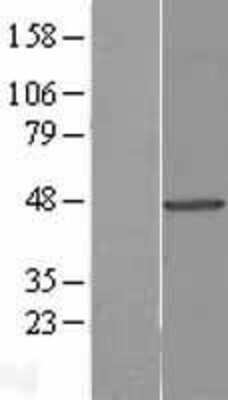 Western Blot: Tuftelin 1 Overexpression Lysate [NBL1-17450]