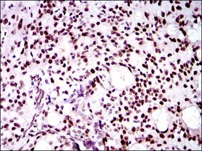 Immunohistochemistry-Paraffin: Twist-1 Antibody (10E4E6) - BSA Free [NBP2-37364]