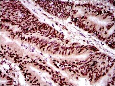 Immunohistochemistry-Paraffin: Twist-1 Antibody (10E4E6) - BSA Free [NBP2-37364]