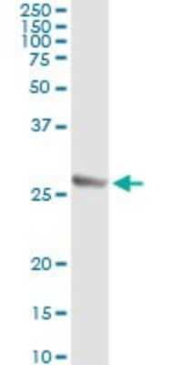 Immunoprecipitation: Twist-1 Antibody (3E11) [H00007291-M01]
