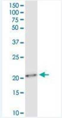 Western Blot: Twist-1 Antibody (3E11) [H00007291-M01]