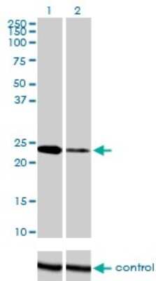 Western Blot: Twist-1 Antibody (3E11) [H00007291-M01]