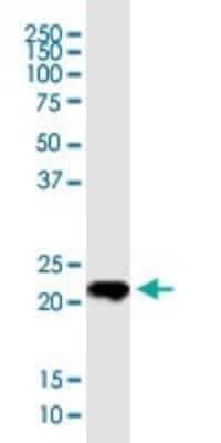 Western Blot: Twist-1 Antibody (3E11) [H00007291-M01]