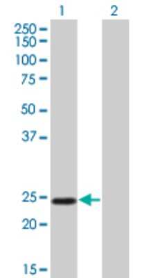 Western Blot: Twist-1 Antibody (3E11) [H00007291-M01]